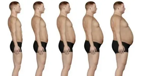 СЗО обяви: Има епидемия от затлъстяване