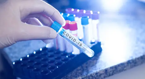 3983 са новозаразените с COVID-19 &ndash; 40,7% от тестваните, 129 са починали