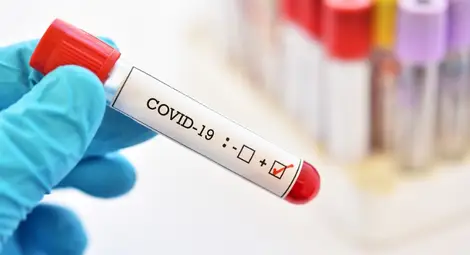 Активните случаи на коронавирус в Русенска област паднаха под 1000