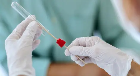 161 са новите случаи на COVID-19 у нас