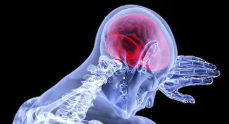 Един на всеки четирима е застрашен от инсулт Един на всеки четирима е застрашен от инсулт