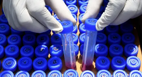 545 са новите случаи на коронавирус - 9,5 процента от тестовете