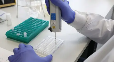 Увеличават се случаите на повторно заразяване с коронавирус в Кипър