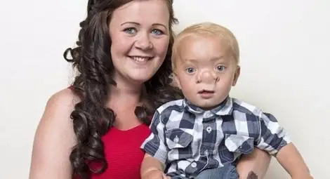 Истинският Буратино пребори мъчителна болест с усмивка /галерия/