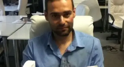 Фенове на "Левски" пребиха журналист