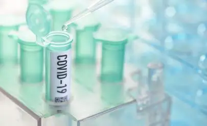 15 нови носители на коронавирус, 34 оздравели и 4 починали в Русенска област за денонощие